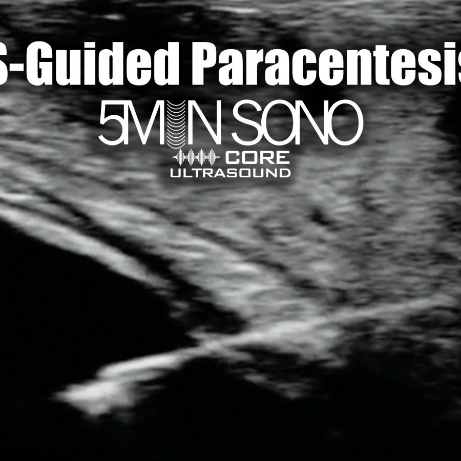 Volume Responsiveness LVOT VTI Core Ultrasound Volume Responsiveness LVOT VTI Core Ultrasound