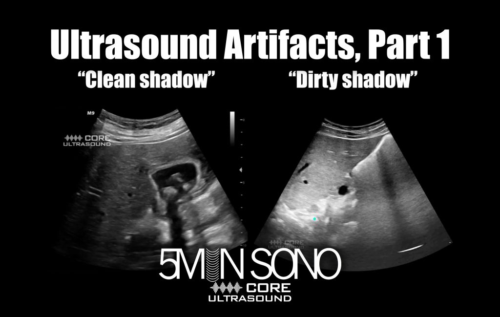Ultrasound Artifacts, Part 1 Core Ultrasound