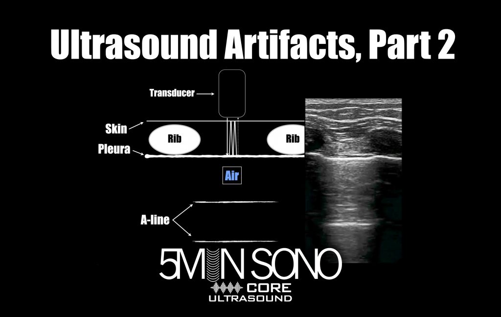 Ultrasound Artifacts, Part 2 Core Ultrasound